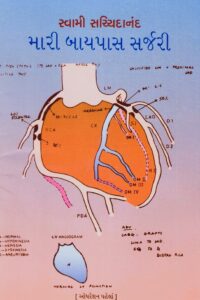 MARI BYPASS SURGERY