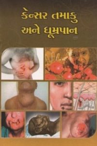 CANCER TAMAKU ANE DHUMRAPAN
